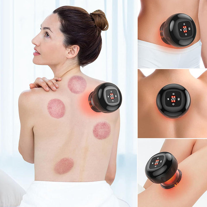 Skanto | Vakuum Cupping & Skrapeverktøy