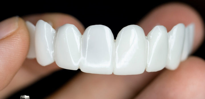Kosmetische Zahnaufsätze von SmileShape – Wiederverwendbar, fleksibel og naturlig hvit