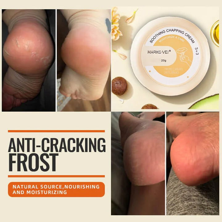 Winter Anti-Rip Frost | Skanto