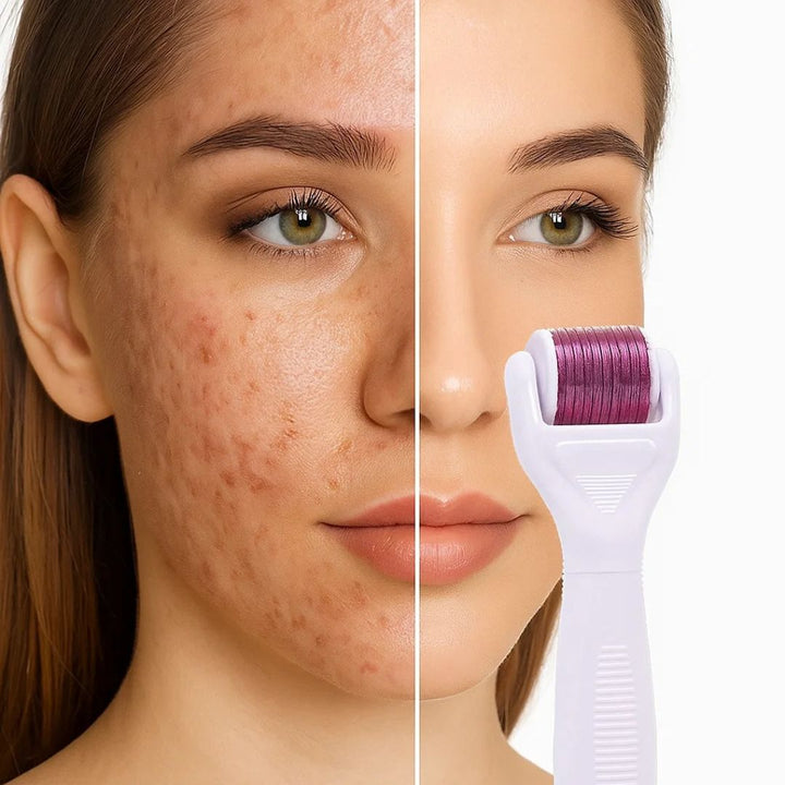 DermaGlow Mikronål Derma Roller Sett – Anti-Aging – Titan Nåler – Hjemmepleie for Kvinner Skanto