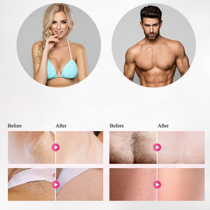 Skanto | Profesjonell IPL Epilator Laser Hårfjerning