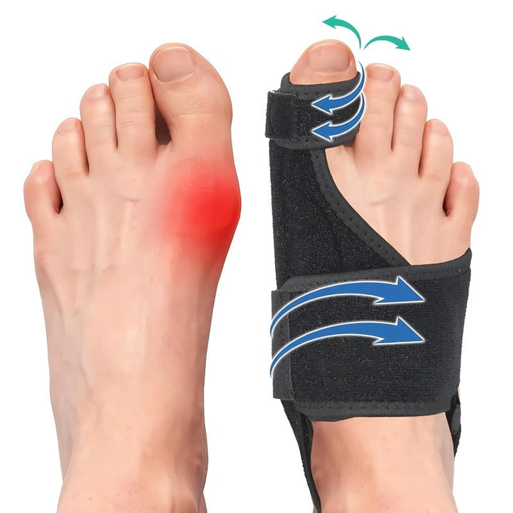 Skanto | Justerbar hallux valgus korrektor