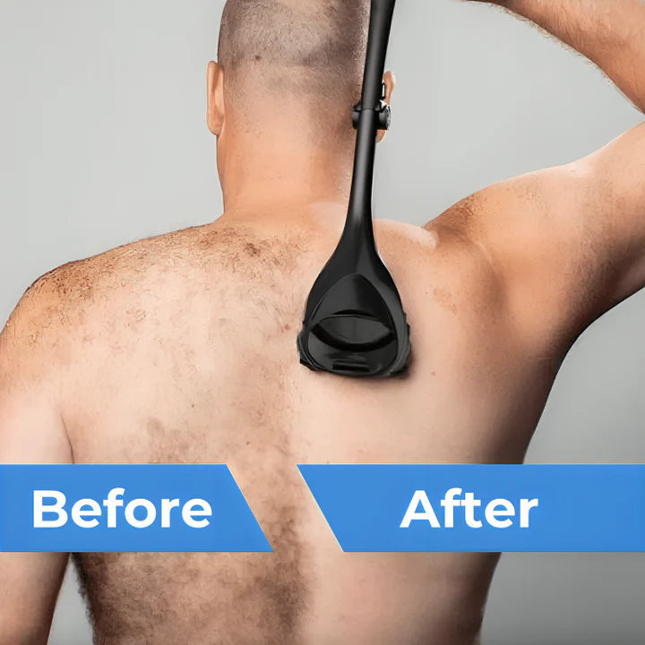 Skanto | BackBliss — Smertefri til silkeaktig glatt hud som gir deg selvtillit
