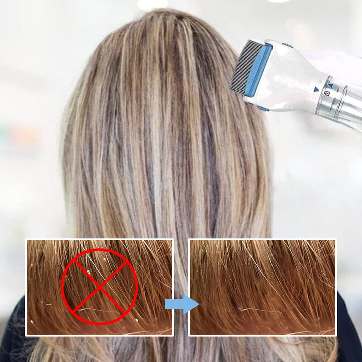 Skanto | V-Comb Hodelus Maskin Med 3 Filtre