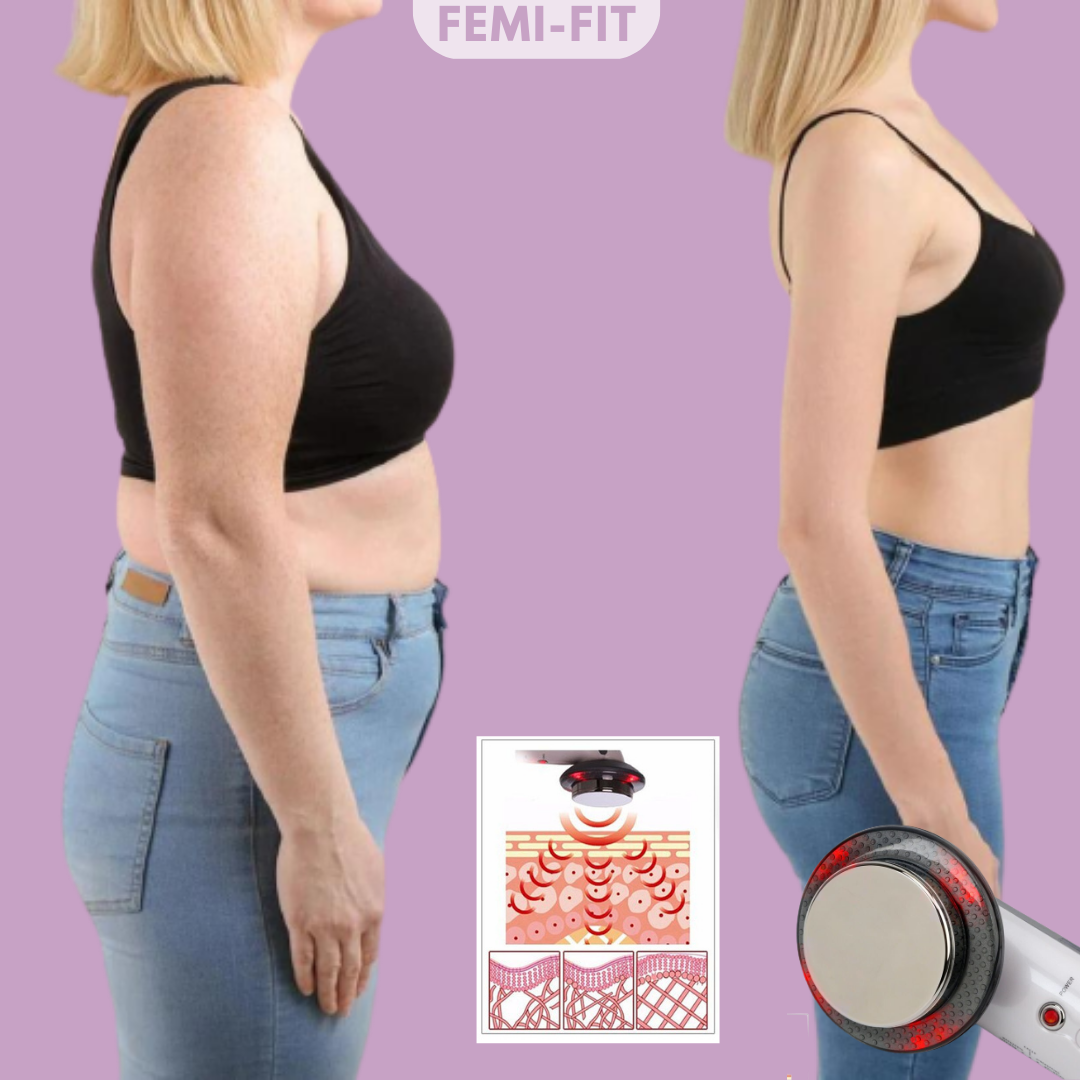 Skanto | 3-i-1 Vet og Cellulite Fjerner - SlimShape