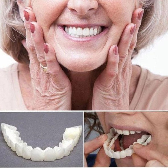 Skanto | På Smile Veneers (Øvre og Nedre Kjeve inkludert)