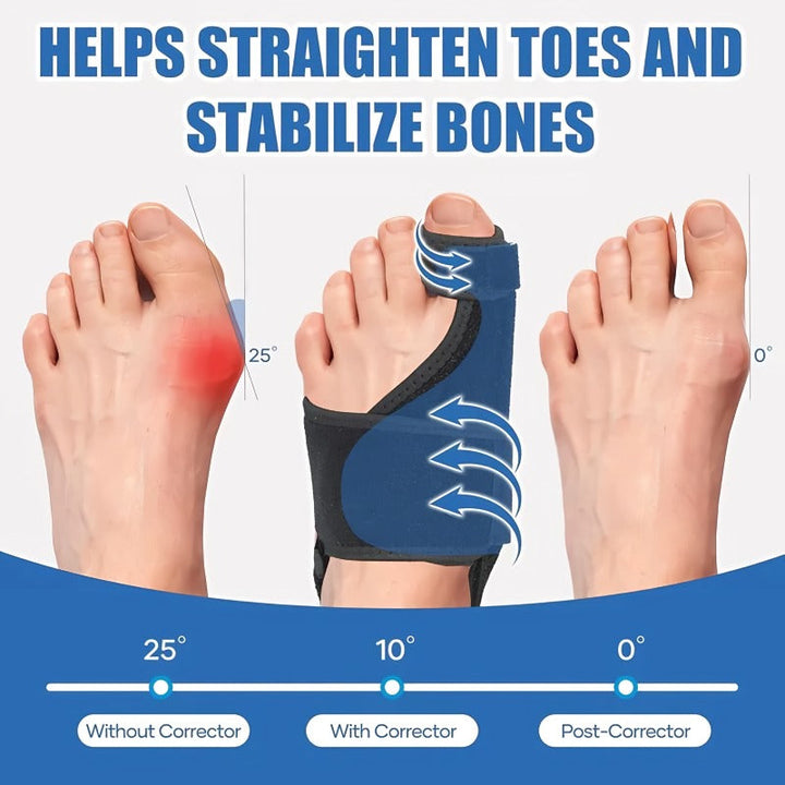 Skanto | Justerbar hallux valgus korrektor