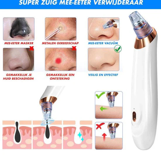 Skanto | Elektrisk Blackhead Fjerner