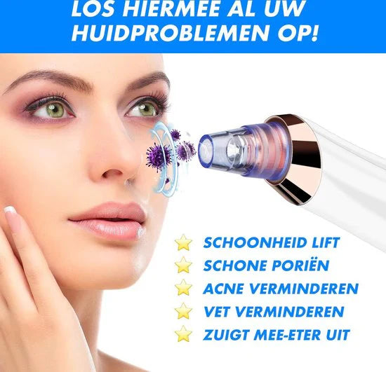 Skanto | Elektrisk Blackhead Fjerner