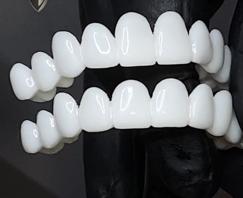 Kosmetische Zahnaufsätze von SmileShape – Wiederverwendbar, fleksibel og naturlig hvit