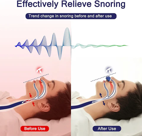 Skanto | Micro CPAP søvnapné maskin for reise og anti-snorking - CPAP alternativ