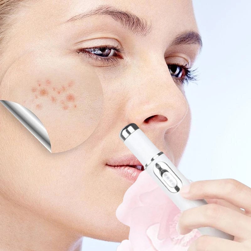 Skanto | ClearDerm - Rask, smertefri kvisefjerning for jevn, klar hud