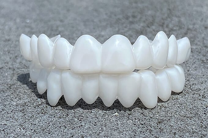 Kosmetiske Tann Toppers SmileShape – Gjenbrukbar, Fleksibel og Naturlig Hvit | Skanto