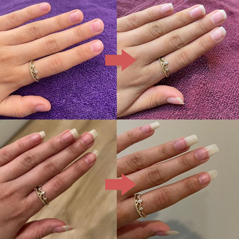 Skanto | Nails Næringsrikt Vekstolje