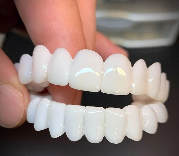 Smile Lens – Justerbar hvit tannprotese for umiddelbar smilkorreksjon | Skanto