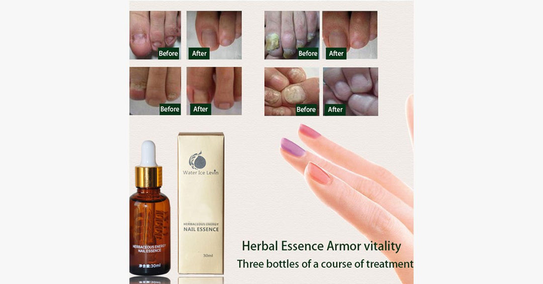 Skanto | Wonder Nail Essence – Den beste løsningen for sunne negler