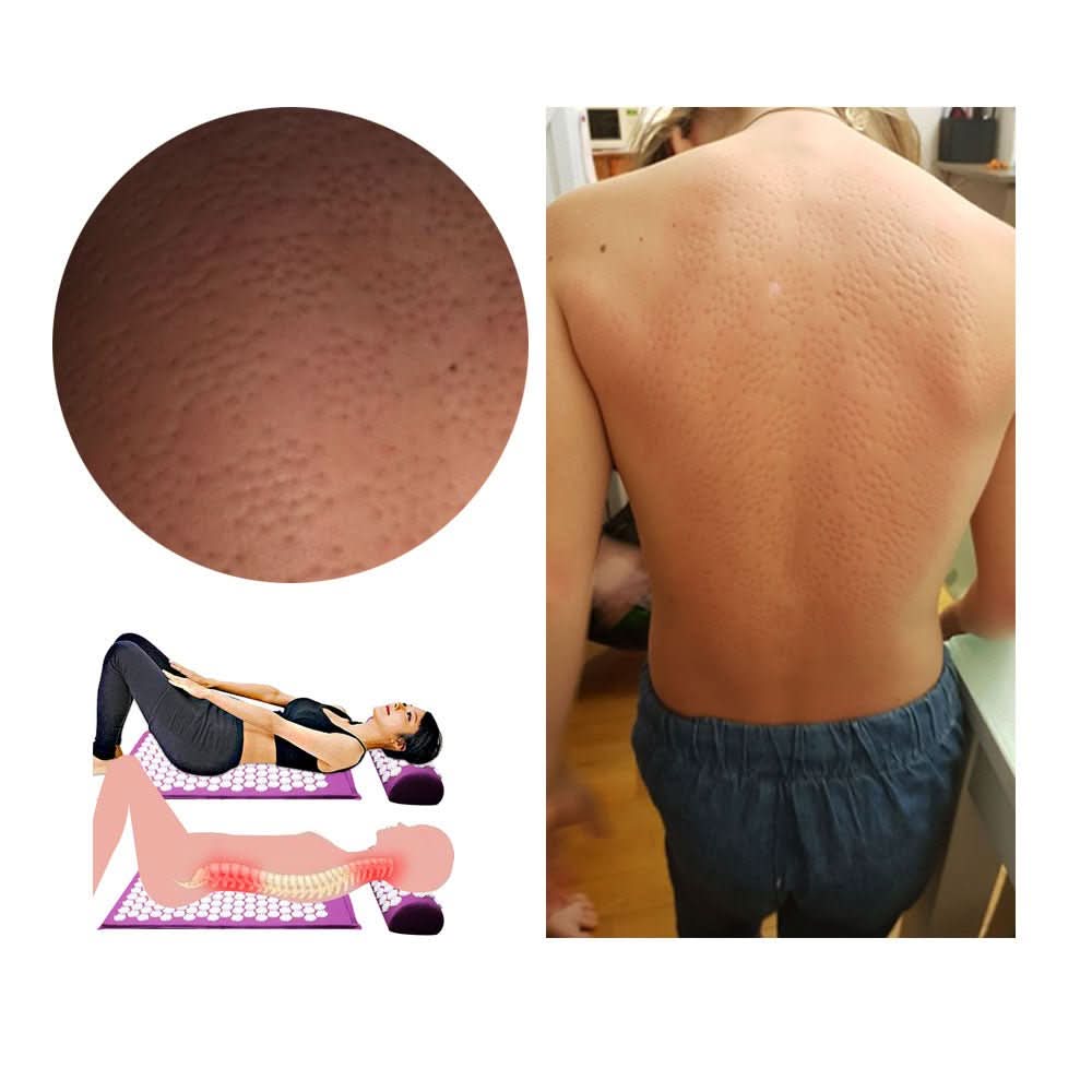 Skanto | Akupressur yogamatte & pute sett for naturlig smertelindring & avslapning