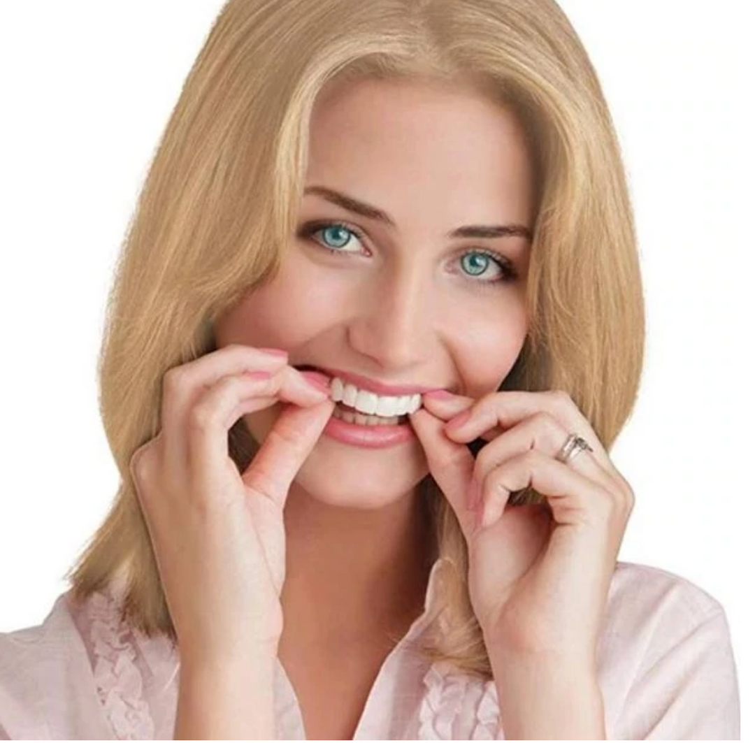 Skanto | HappySmile Facet sett | Gjenbrukbare øvre og nedre fasetter for et strålende smil
