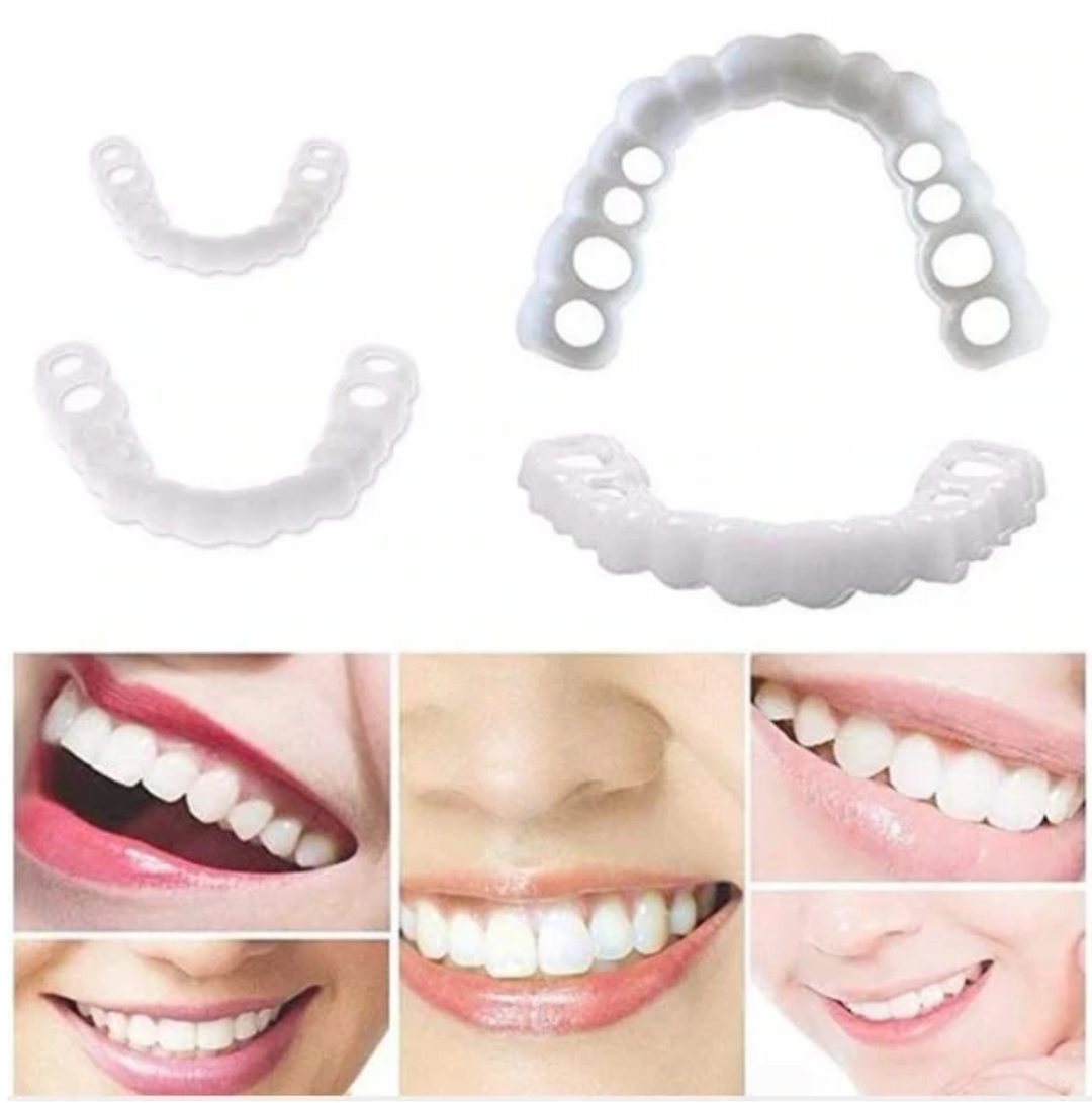 Skanto | HappySmile Facet sett | Gjenbrukbare øvre og nedre fasetter for et strålende smil
