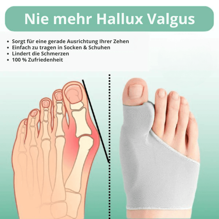 CompressCare Teen – Hallux-valgus-Korrektur for schmerzfreies Gehen