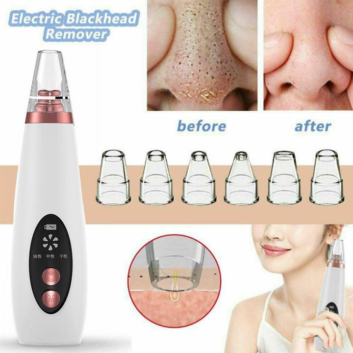 Skanto | Pure Skin Oppladbar Blackhead Fjerner Maskin