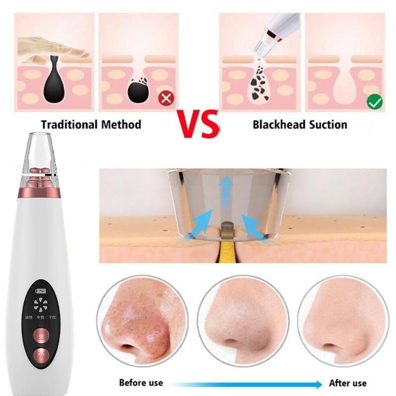 Skanto | Pure Skin Oppladbar Blackhead Fjerner Maskin