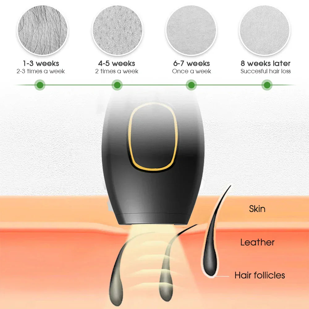 Skanto | Bikini IPL 500 000 Flash Epilator Impuls Permanent Laser Epilator Smerteløs For Kvinner Hårfjerning Hjemmebruk Enheter
