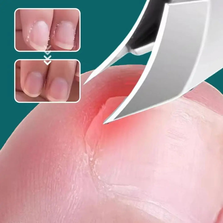 Skanto | Curved Edge Sharp Ingroddnegl Klipper