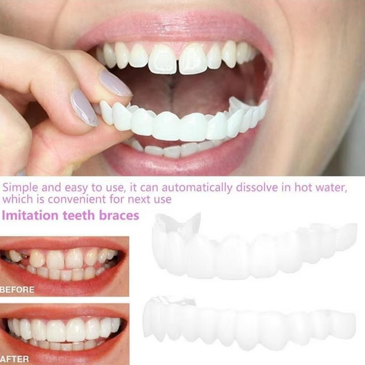 Skanto | 2PCS Snap-On Veneer Proteser for Menn og Kvinner, Umiddelbar Midlertidig Tannbeskyttelse for et Selvsikkert Smil