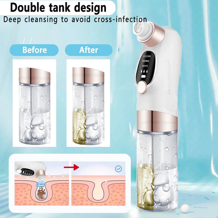 Skanto | Acne Black Head Deep Clean Removal