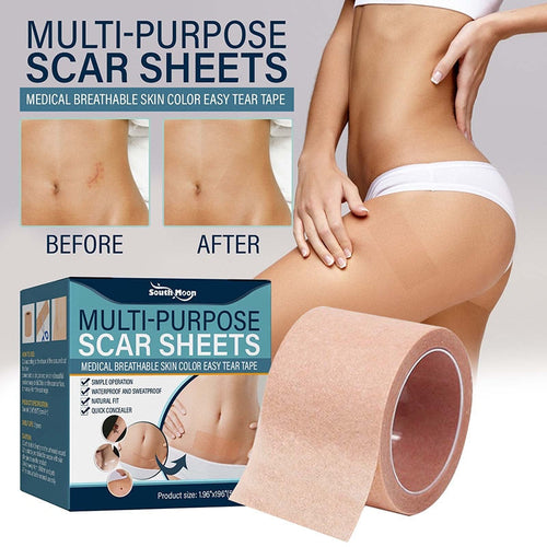 Myk silikongel tape for arrfjerning | Skanto