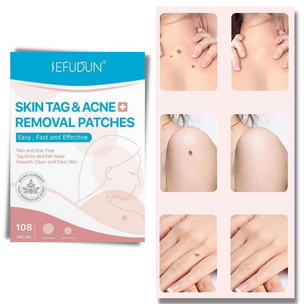 Skanto | Hudplaster - Fjern føflekker og vorter på en naturlig måte!