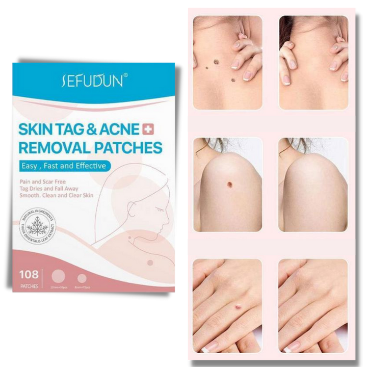 Skanto | Hudplaster - Fjern føflekker og vorter på en naturlig måte!