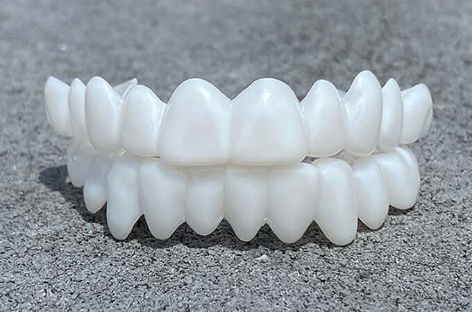 Anpassbare Zahnprothese mit Zahnlinsen