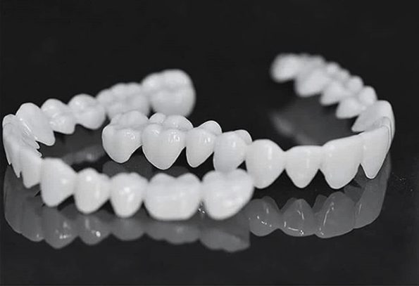 Anpassbare Zahnprothese mit Zahnlinsen