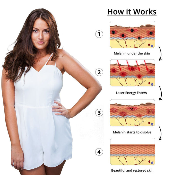 Tatoveringsfjerning laser