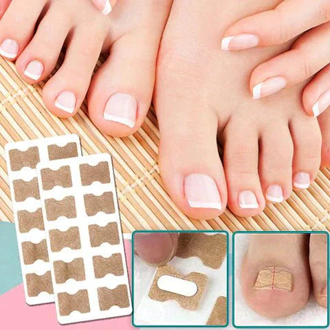 ALIGNSTRIP – Schmerzfreie Nagelkorrekturstreifen for eingewachsene und deformierte Nägel