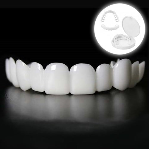Sofortige Verschönerung Ihres Lächelns med Snap-on-Veneers