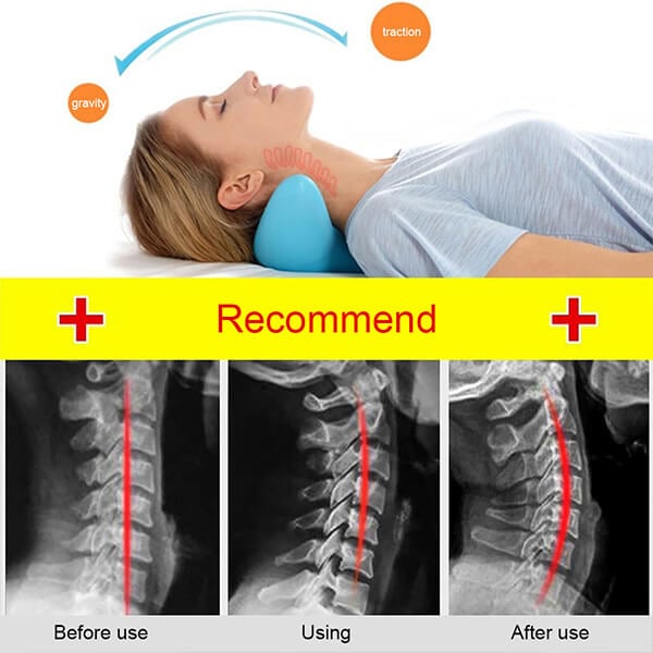 NeckEase Stretch – Ergonomisk Nakkepute for Nakkavslapning | Skanto