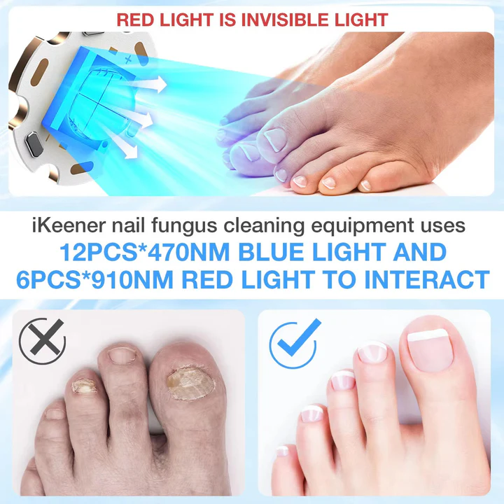Skanto | Neglesopp Laser