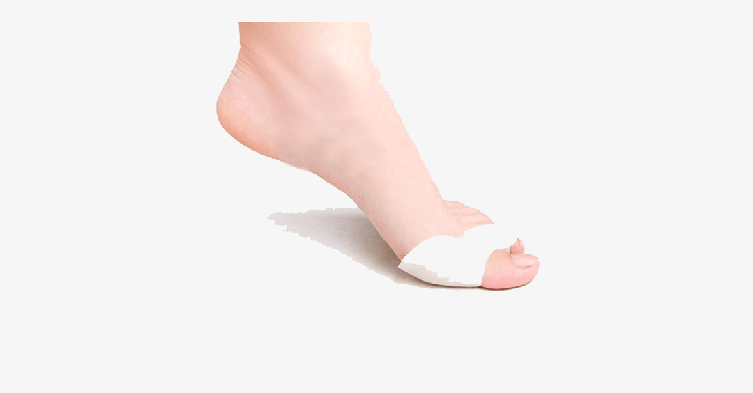 Skanto | Komfort Helbredende Tåseparatorer og Hallux Valgus Avstandholdere