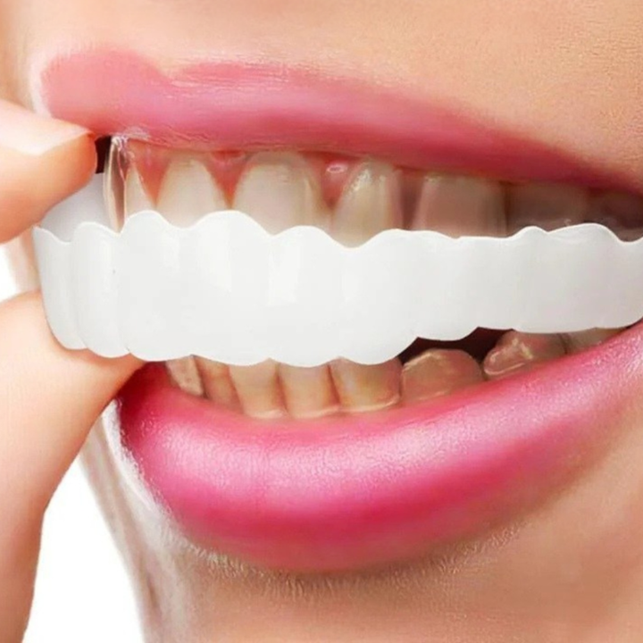 Herausnehmbare Veneers-Zahnverblendschalen