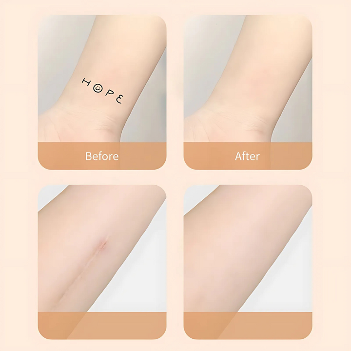 Skanto | Arr Concealer Patches Vanntett Huddeksel