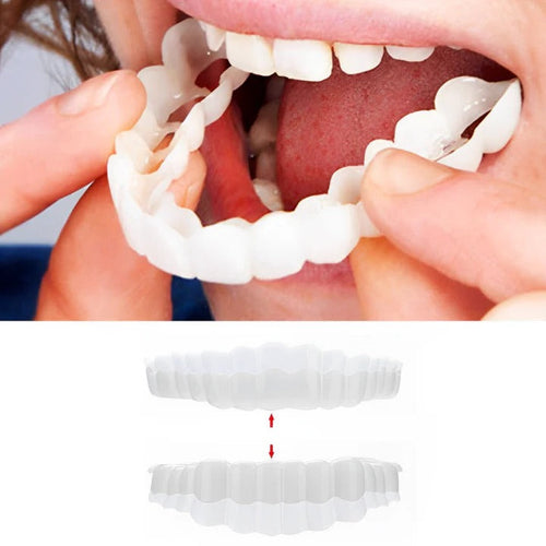 Skanto | Avtagbare Smile Veneers for Øvre og Nedre Tenner