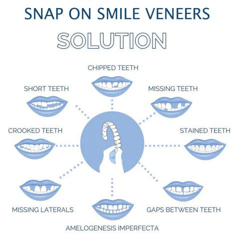 Skanto | Avtagbare Smile Veneers for Øvre og Nedre Tenner