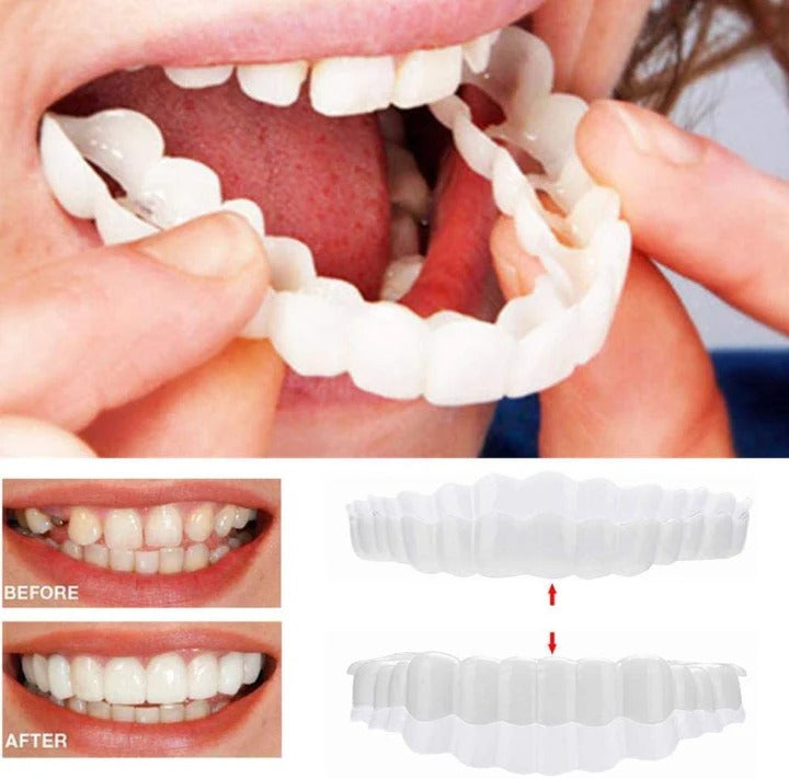Skanto | Avtagbare Smile Veneers for Øvre og Nedre Tenner
