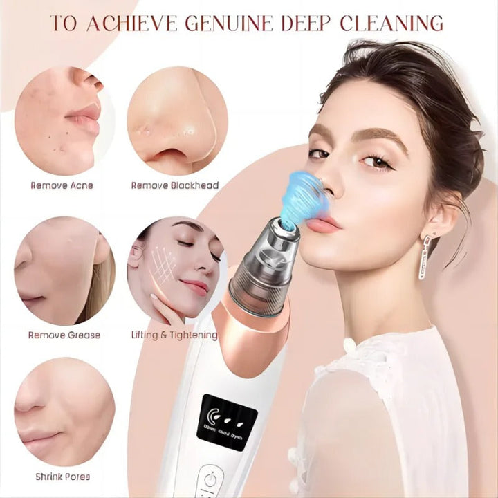 Skanto | Blackhead Remover Vacuum Pore Cleaner | Justerbart sug, multifunksjonelt verktøy for dyp rensing og aknebehandling hjemme