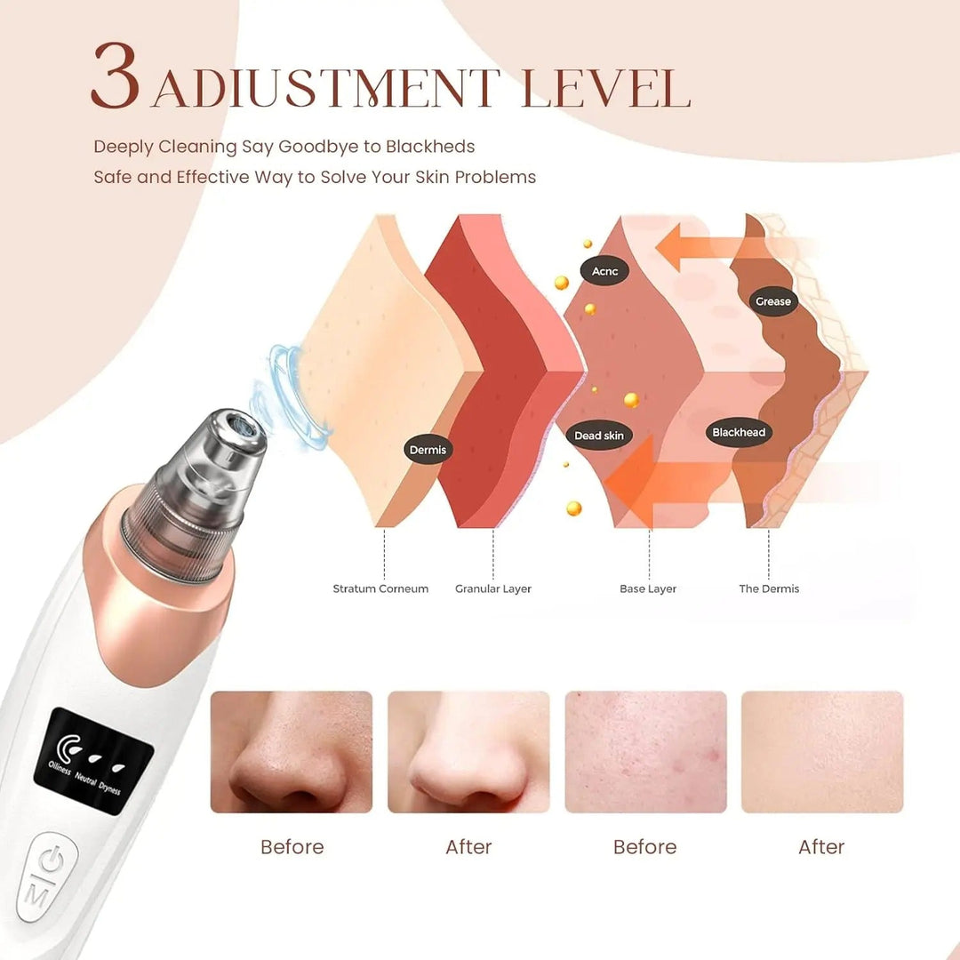 Skanto | Blackhead Remover Vacuum Pore Cleaner | Justerbart sug, multifunksjonelt verktøy for dyp rensing og aknebehandling hjemme