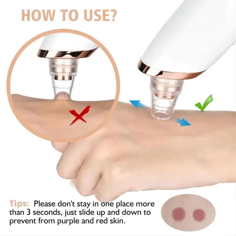 Skanto | Blackhead Remover Vacuum Pore Cleaner | Justerbart sug, multifunksjonelt verktøy for dyp rensing og aknebehandling hjemme