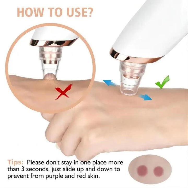 Skanto | Blackhead Remover Vacuum Pore Cleaner | Justerbart sug, multifunksjonelt verktøy for dyp rensing og aknebehandling hjemme
